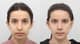 Slider image (6) AB Plastic Surgery